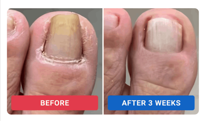 orivelle review Drew A.